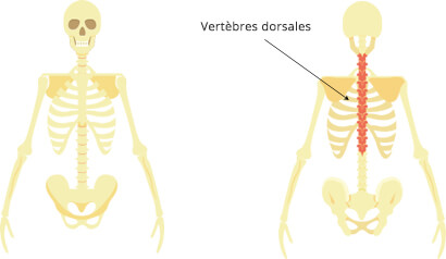 dorsalgie-définition