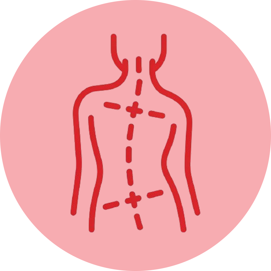 Schéma de la scoliose idiopathique de l'adulte