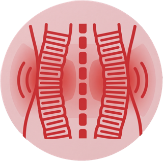 Illustration d'une contracture musculaire de part et d'autre de la colonne lombaire en cas de lumbago